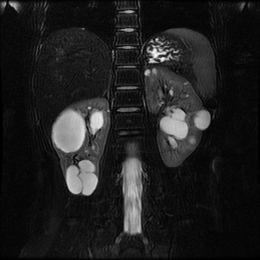 2015 kidneys